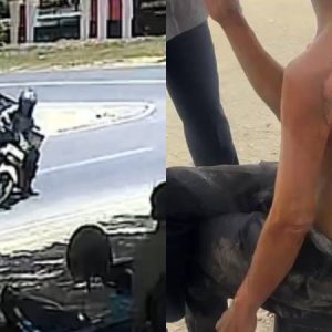Ban Motor Terselip Saat Belok, Pedagang Bakso di Konawe Melepuh Terkena Air Panas